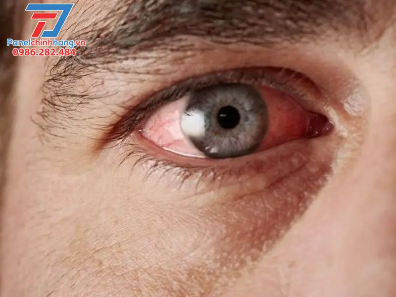 Cách trị ngứa bông thủy tinh trong các trường hợp đặc biệt
